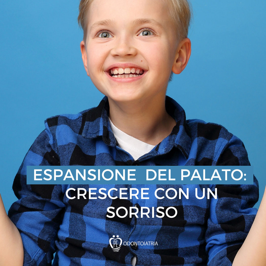 Espansione Rapida del Palato nei Bambini
